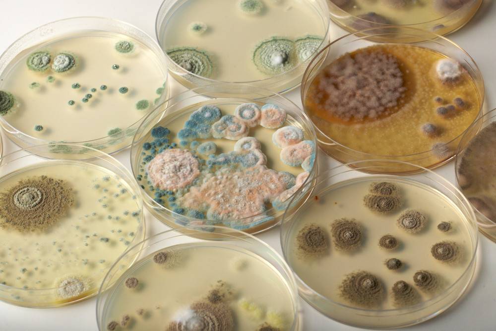 Грибы. одноклеточные, плесневые, шляпочные грибы. грибы-паразиты. - bio-lessons